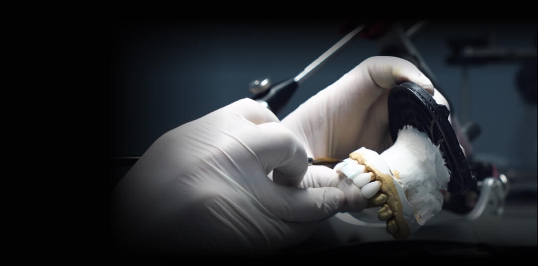 Dental Lab | Denture Manufacturer | Denture Care