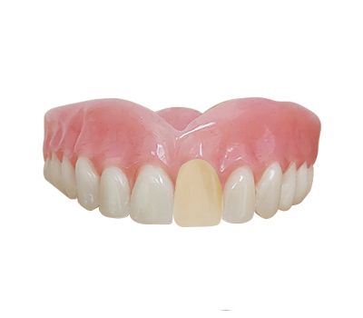 Full Zirconia